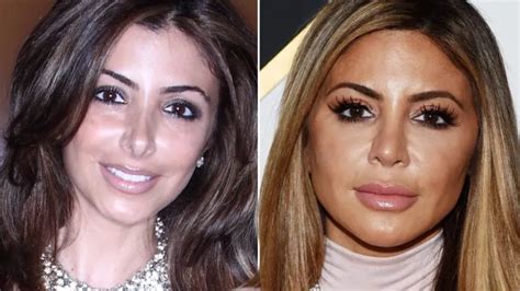 larsa pippen butt before|All The Cosmetic Procedures RHOM Star Larsa Pippen Admits。